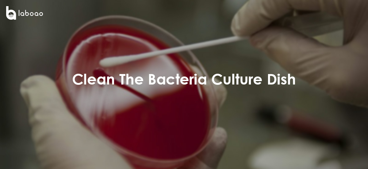How To Properly Clean The Bacteria Culture Dish?